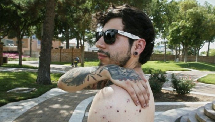 Daniel Munoz reaches for his injured back during an interview, Sunday, September 1, 2019, in Odessa, Texas. Munoz was injured in Saturday's shooting. The tattoo on his right hand is a biblical reference, that the wages of sin are death and God's gift is everlasting life. Photo: AP