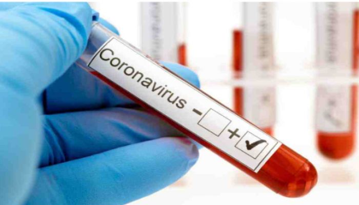 2 More Test Positive for Coronavirus in Keraniganj  