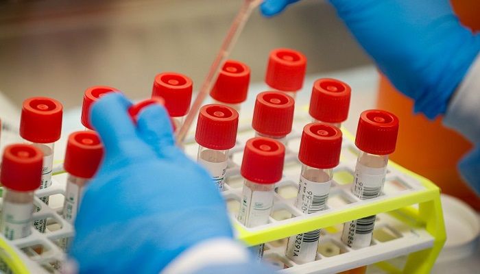 Govt Allows 3 Private Hospitals to Test Coronavirus