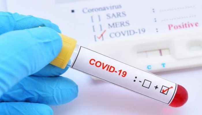 266 More Test Positive for COVID-19 in Bangladesh