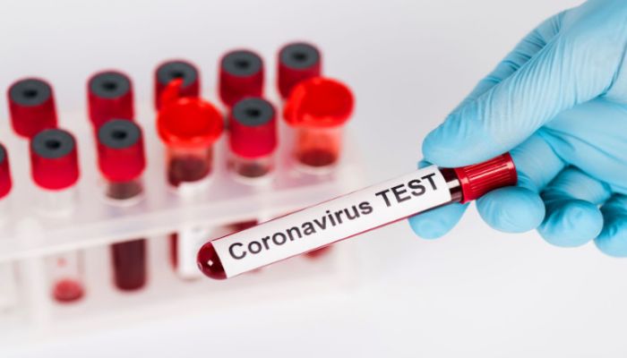 Doctor among 17 Test Coronavirus Positive in Laxmipur