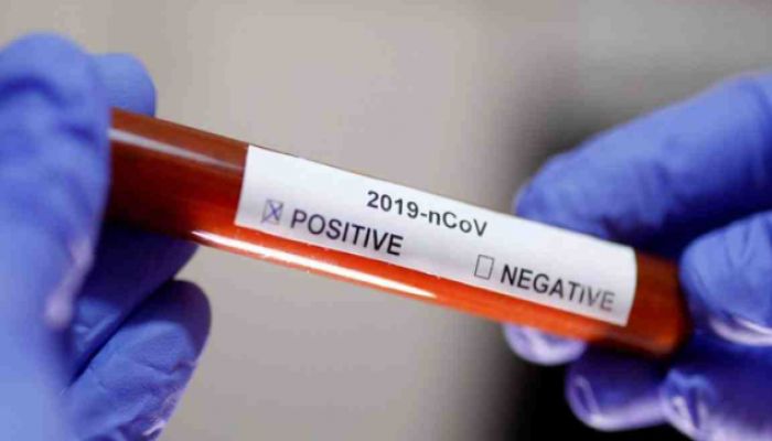Unauthorised Coronavirus Testing Kits Can’t Be Used: Ministry