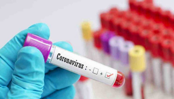 COVID-19: Foreigner, 21 Others Infected in Chattogram 