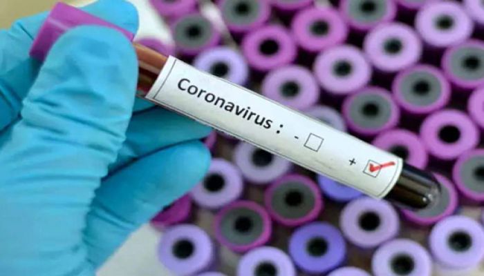 161 More Test Positive for COVID-19 in Ctg