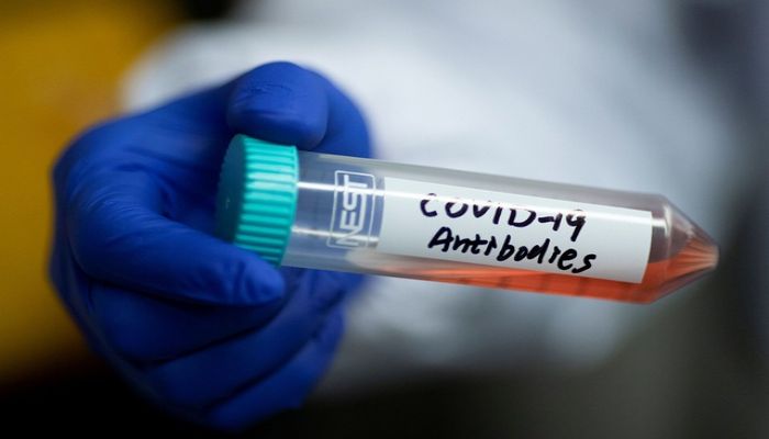 Israel Isolates Coronavirus Antibody in 'Significant Breakthrough': Minister 