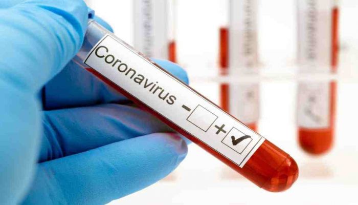 3 More Thakurgaon BGB Men Infected with Covid-19  