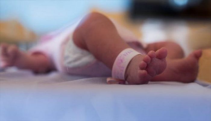 Baby Born with Two Heads Dies in Jashore   