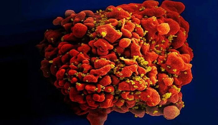 New 'Highly Virulent' HIV Strain Discovered in the Netherlands  
