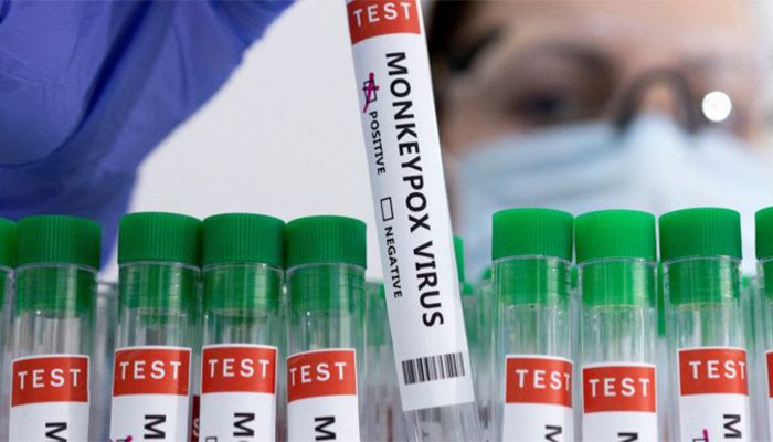Monkeypox Detected in UAE