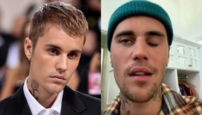 Justin Bieber Reveals Facial Paralysis after Shows Cancelled