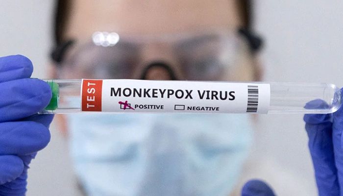 Authorities Detect Suspected Monkeypox Patient at Dhaka Airport   
