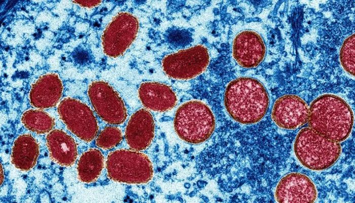 US Identifies First Cases of Monkeypox in Children     