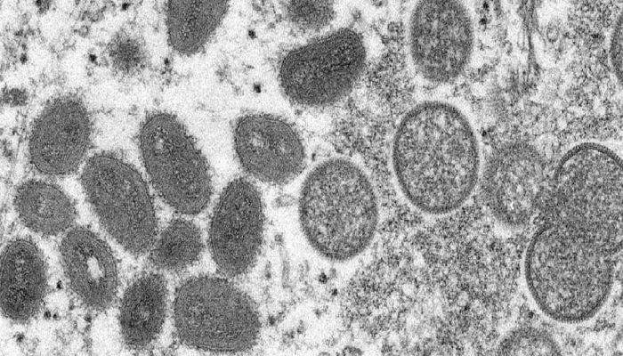 India Reports First Monkeypox Death