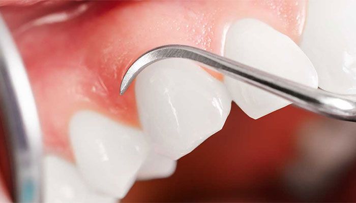 Periodontology: A Blooming Flower of Dentistry in Bangladesh