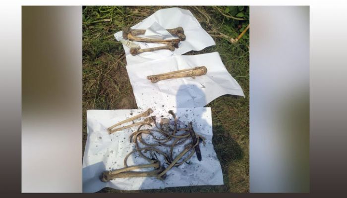 MP Anar’s Bones Found At Kolkata North 24 Parganas 